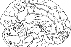 Brain_OL